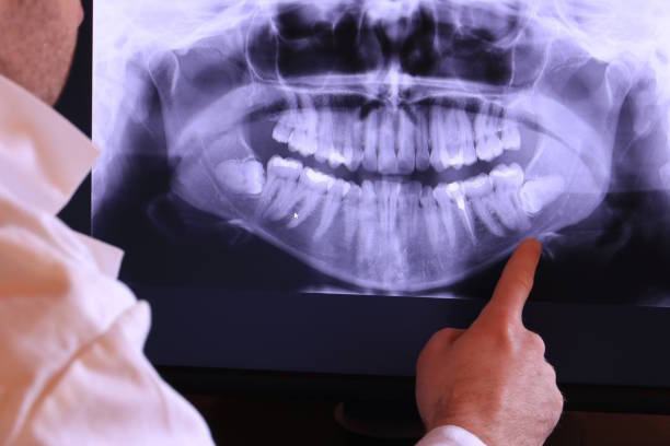 Best Dental Abscess Treatment in Camden, NJ